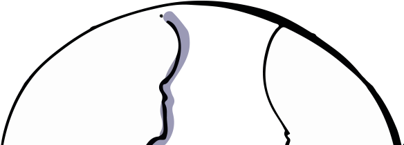 1-globe